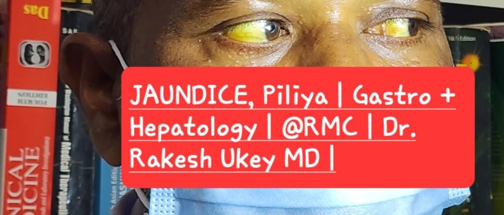 JAUINDICE, Piliya | Castro +
Hepatology | @RMC | Dr.
Rakesh Ukey MD I
